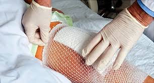 Elastic Cohesive Bandage